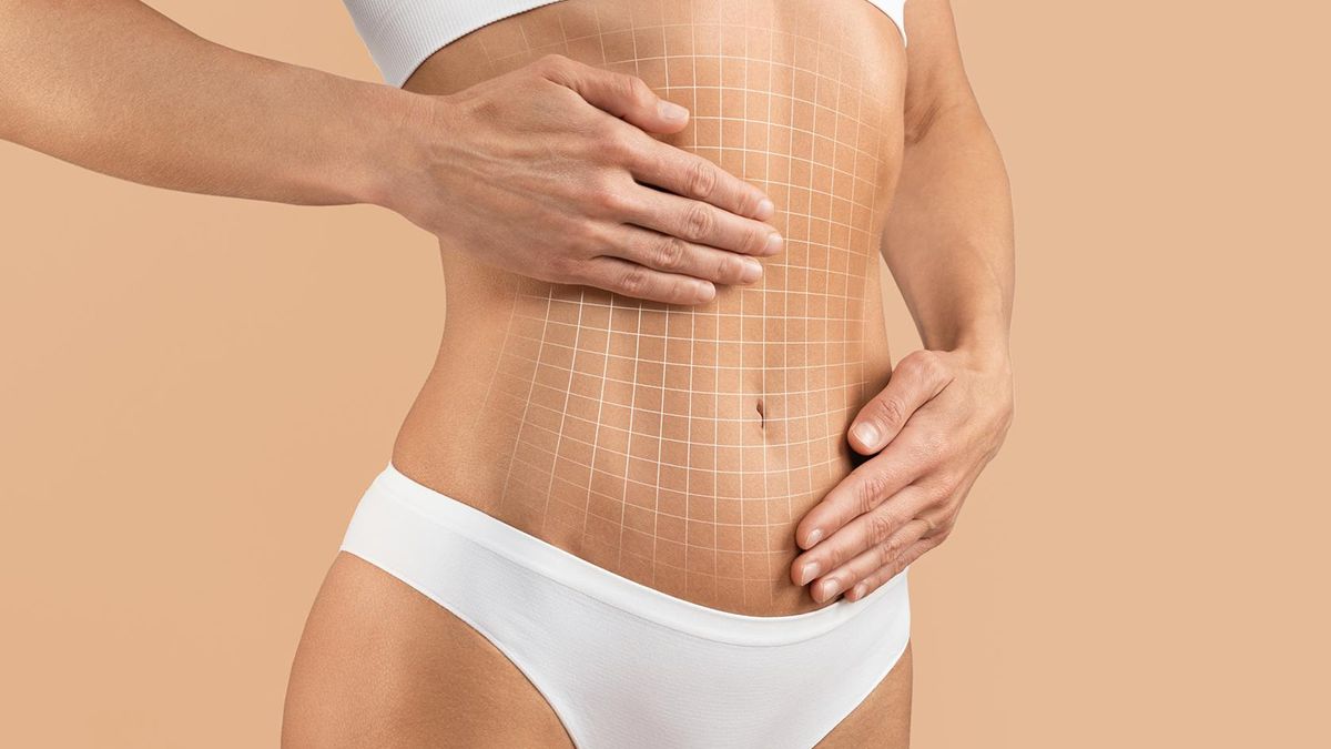 Ce înseamnă cu adevărat operația de abdominoplastie